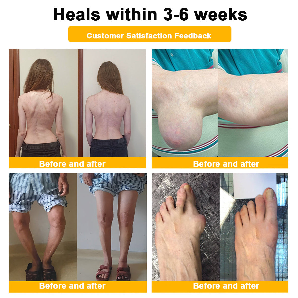 ⏰FLASH SALE: 59% OFF🔥LUMIVO™ Botulinum Toxin & Bee Venom Pain-Relief Bone Healing Cream