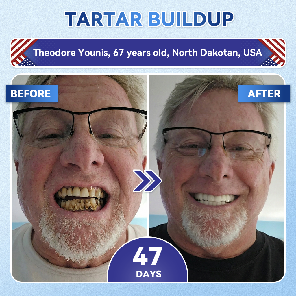 GаrаgеLіnе® 🦷 Tideglusib Oral Strips 💡 Fast-Dissolving Tooth & Gum Care for Stronger, Healthier Smiles 😁