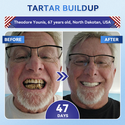 GаrаgеLіnе® 🦷 Tideglusib Oral Strips 💡 Fast-Dissolving Tooth & Gum Care for Stronger, Healthier Smiles 😁