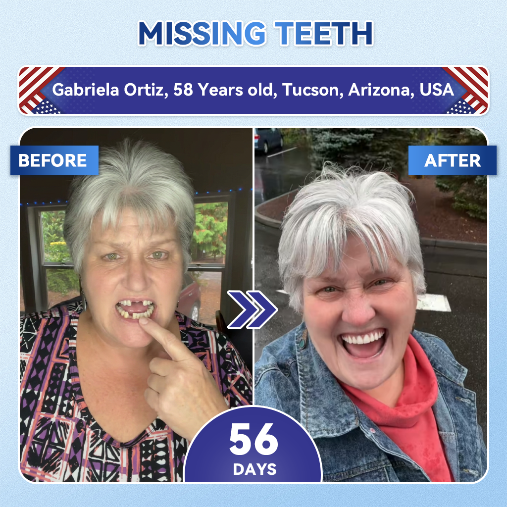 GаrаgеLіnе® 🦷 Tideglusib Oral Strips 💡 Fast-Dissolving Tooth & Gum Care for Stronger, Healthier Smiles 😁