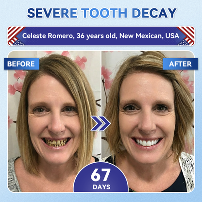 GаrаgеLіnе® 🦷 Tideglusib Oral Strips 💡 Fast-Dissolving Tooth & Gum Care for Stronger, Healthier Smiles 😁