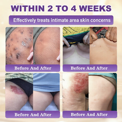 ✨Made and Shipped from USA ✨QIAWI® Biotin 10-in-1 Skin Restoration Cream 🍀