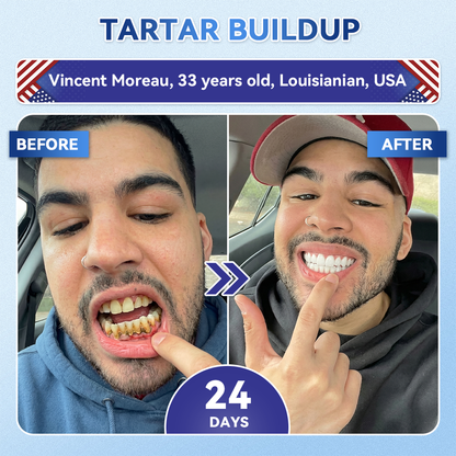 GаrаgеLіnе® 🦷 Tideglusib Oral Strips 💡 Fast-Dissolving Tooth & Gum Care for Stronger, Healthier Smiles 😁