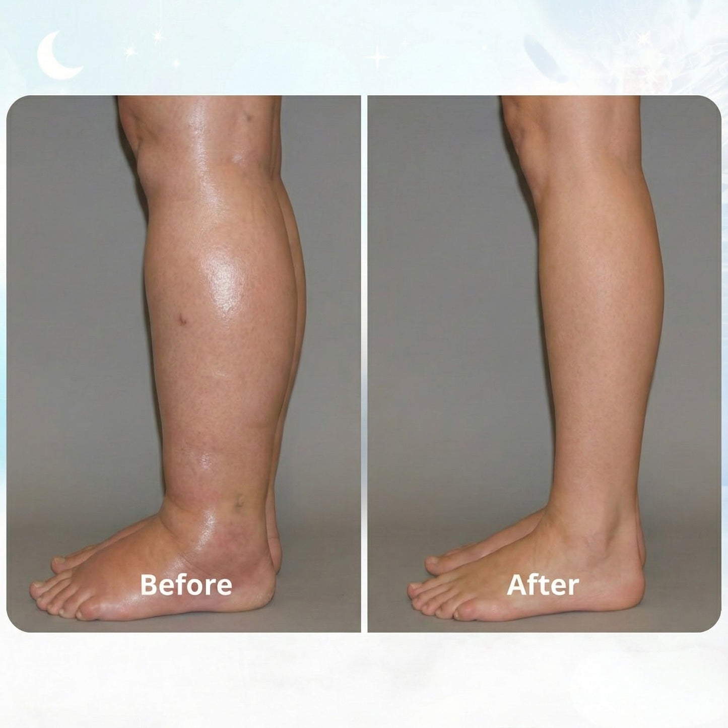 ORNEXIS - EMS FIX SWOLLEN LEGS FROM HOME